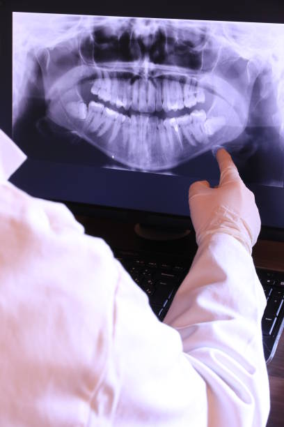 Best Emergency Dentist for Lost Fillings or Crowns in Archbold, OH